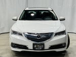 2015 Acura TLX V6 Advance