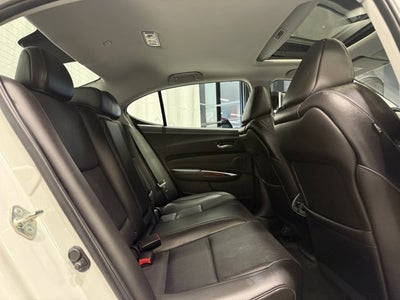2015 Acura TLX V6 Advance